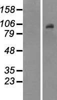 DNMT3B Human Over-expression Lysates NM_006892