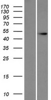 DOM3Z (DXO) Human Over-expression Lysates NM_005510