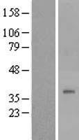 DPAGT1 Human Over-expression Lysates NM_001382
