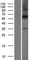 DPAGT1 Human Over-expression Lysates NM_203316