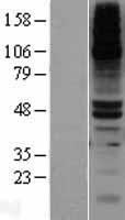 ls001800 dpep1 human over expression lysates nm 001128141 wb testing 2