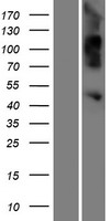 OVCA1 (DPH1) Human Over-expression Lysates NM_001383