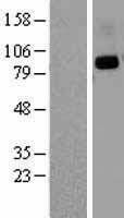 CD26 (DPP4) Human Over-expression Lysates NM_001935