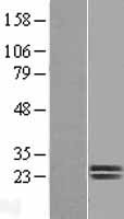 Dermatopontin (DPT) Human Over-expression Lysates NM_001937