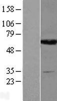 Dihydropyrimidinase (DPYS) Human Over-expression Lysates NM_001385