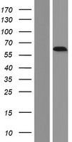 CRMP2 (DPYSL2) Human Over-expression Lysates NM_001386