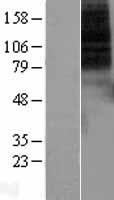 Dopamine Receptor D1 (DRD1) Human Over-expression Lysates NM_000794