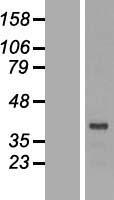 DRG2 Human Over-expression Lysates NM_001388