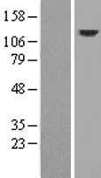 DRP2 Human Over-expression Lysates NM_001939