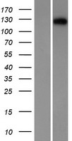Desmocollin 1 (DSC1) Human Over-expression Lysates NM_024421