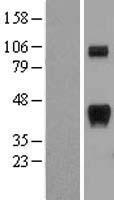 Calcipressin 1 (RCAN1) Human Over-expression Lysates NM_203418