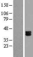 Epiphycan (EPYC) Human Over-expression Lysates NM_004950