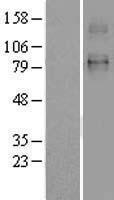 SLC26A2 Human Over-expression Lysates NM_000112