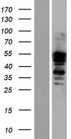 ls001837 dystrobrevin alpha dtna human over expression lysates nm 032980 wb testing 2