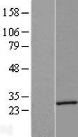 ls001837 dystrobrevin alpha dtna human over expression lysates nm 032981 wb testing 4