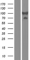 Dystrobrevin beta (DTNB) Human Over-expression Lysates NM_033147