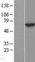 Dystrobrevin beta (DTNB) Human Over-expression Lysates NM_183361