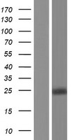 ls001841 dtymk human over expression lysates nm 001165031 wb testing 2