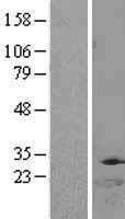 ls001841 dtymk human over expression lysates nm 012145 wb testing 1
