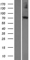ECM2 Human Over-expression Lysates NM_001393