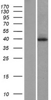 DUSP1 Human Over-expression Lysates NM_004417