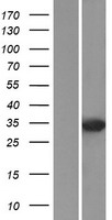 DUSP2 Human Over-expression Lysates NM_004418