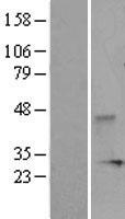 DUSP3 Human Over-expression Lysates NM_004090