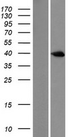 DUSP6 Human Over-expression Lysates NM_001946