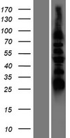 DUSP8 Human Over-expression Lysates NM_004420