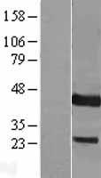DUSP9 Human Over-expression Lysates NM_001395