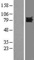 DVL1 Human Over-expression Lysates NM_004421