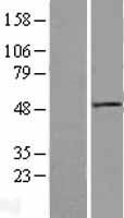DVL1 Human Over-expression Lysates NM_182779