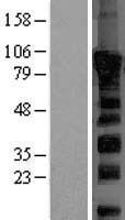 Dishevelled 2 (DVL2) Human Over-expression Lysates NM_004422