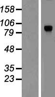 DYRK1A Human Over-expression Lysates NM_130436