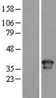 Torsin A (TOR1A) Human Over-expression Lysates NM_000113
