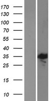 E2F5 Human Over-expression Lysates NM_001951