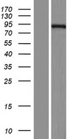 ECE1 Human Over-expression Lysates NM_001113349