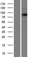 ECE1 Human Over-expression Lysates NM_001397