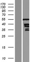 Thymidine Phosphorylase (TYMP) Human Over-expression Lysates NM_001953