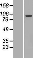 ECT2 Human Over-expression Lysates NM_018098