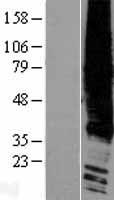 EDG2 (LPAR1) Human Over-expression Lysates NM_057159