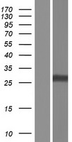 Endothelin 1 (EDN1) Human Over-expression Lysates NM_001168319