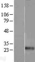 Endothelin 1 (EDN1) Human Over-expression Lysates NM_001955