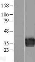 Endothelin 3 (EDN3) Human Over-expression Lysates NM_207034