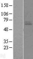 Endothelin A Receptor (EDNRA) Human Over-expression Lysates NM_001957