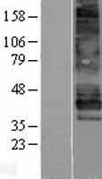Endothelin B Receptor (EDNRB) Human Over-expression Lysates NM_000115