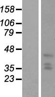 PHC2 Human Over-expression Lysates NM_004427