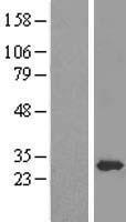 EEF1B2 Human Over-expression Lysates NM_001037663