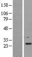 EEF1B2 Human Over-expression Lysates NM_001959