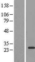 EEF1B2 Human Over-expression Lysates NM_021121